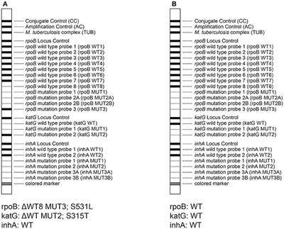 Evaluation of Genotype MTBDRplus and MTBDRsl Assays for Rapid Detection of Drug Resistance in Extensively Drug-Resistant Mycobacterium tuberculosis Isolates in Pakistan